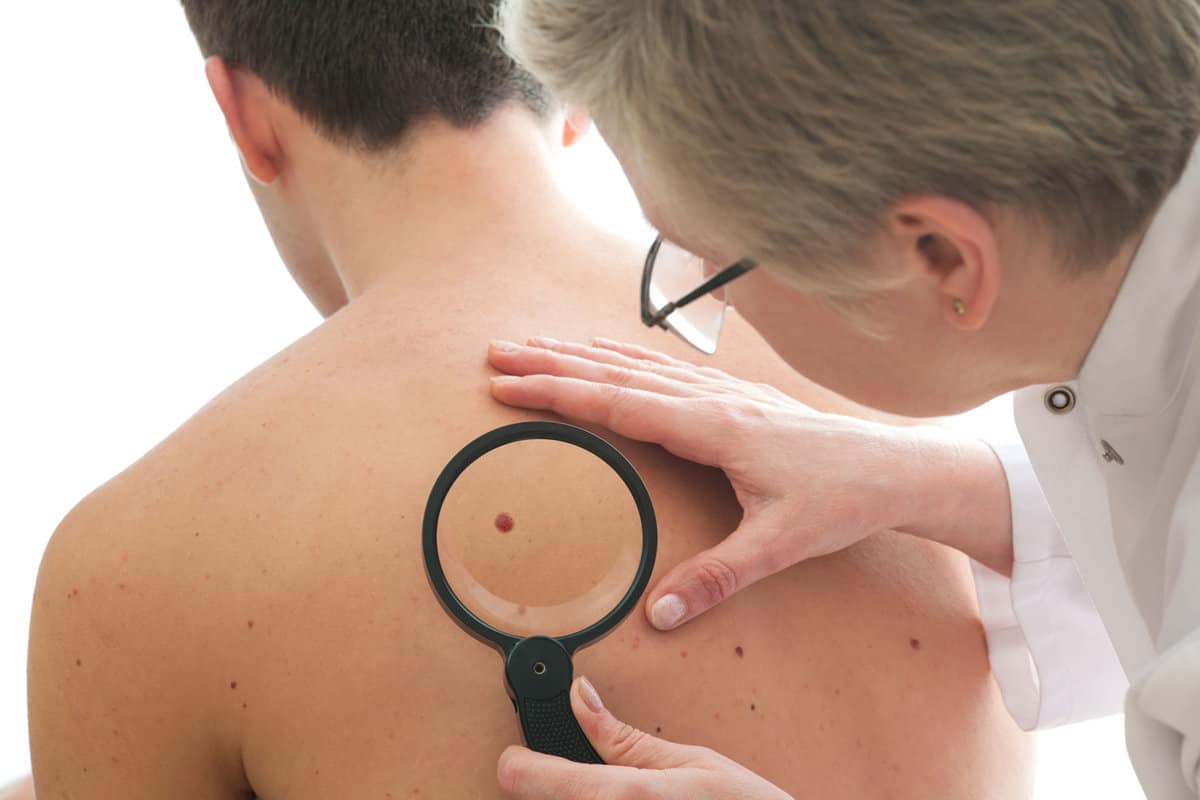 Dermatologists detecting skin cancer on patients back